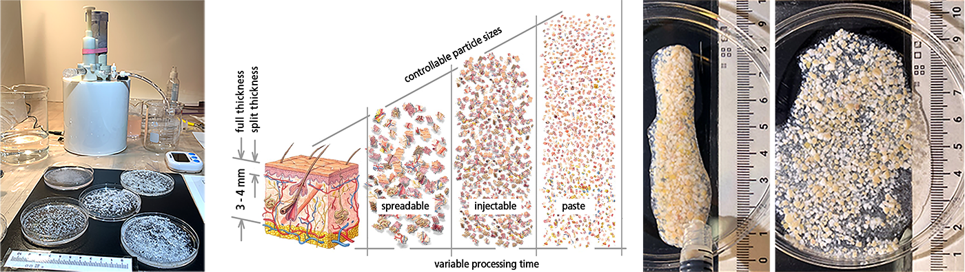 tissue being atraumatically processed into smaller particulates for desired applications