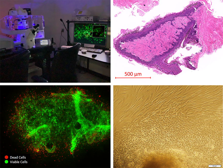 FactorsNY processed freshly harvested human abdominoplasty tissue for confocal microscopy at Feinstein Institute for Medical Research to verify highly viable cell output