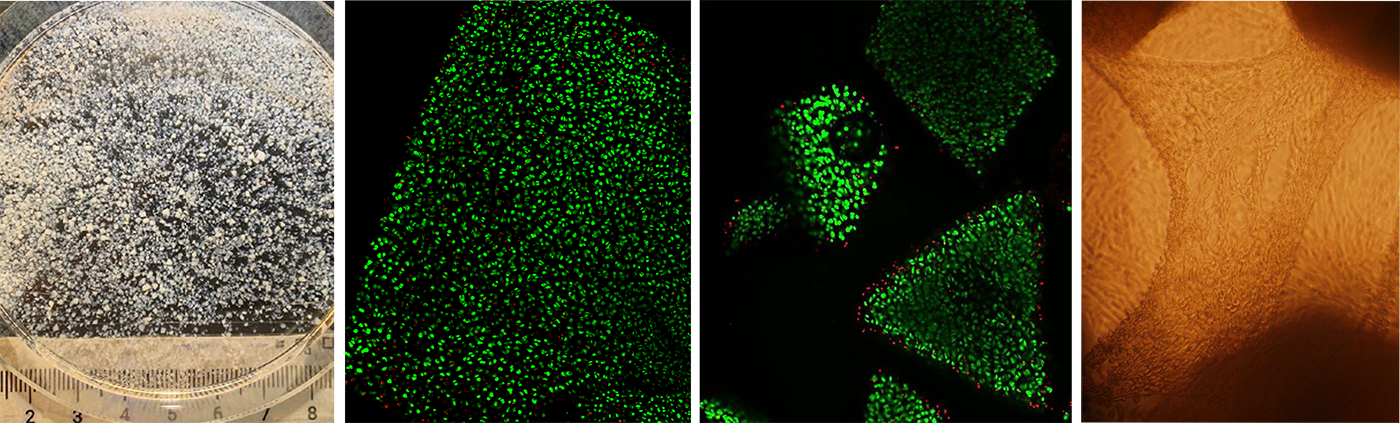 Bovine articular cartilage is also rapidly processed into progressively smaller highly viable micro-particles